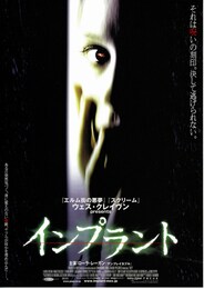 インプラント