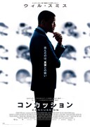 コンカッション