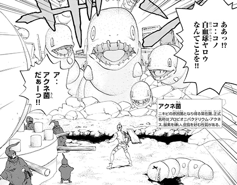 アクネ菌