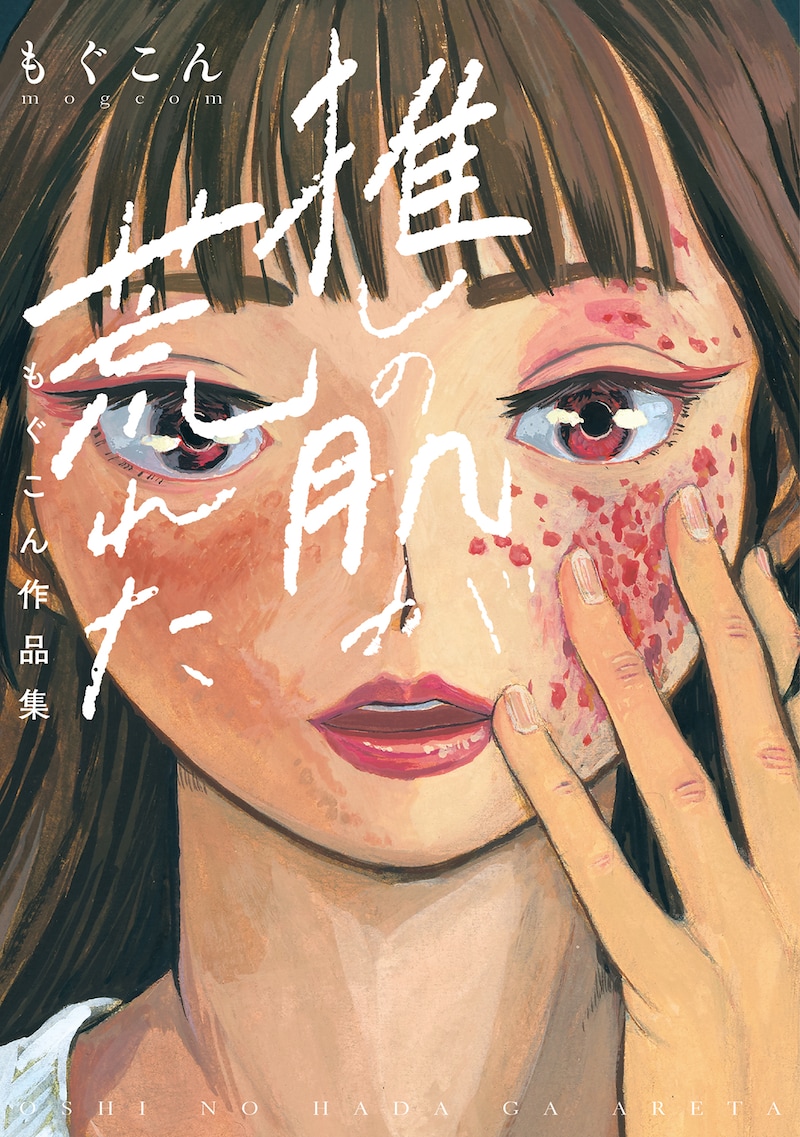 「推しの肌が荒れた~もぐこん作品集~」