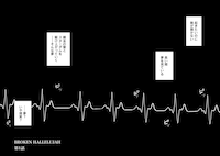 「ブロークンハレルヤ」より