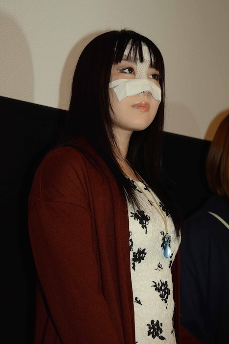 試合で失明した安川は、先週退院したばかりのため、まだもののシルエットがわかる程度だという。