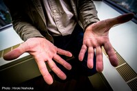 ユーリー・ノルシュテインの手。