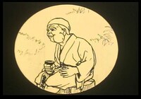 「漫画 瘤取り」