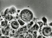 「生命の流れ ―血液を探る―」