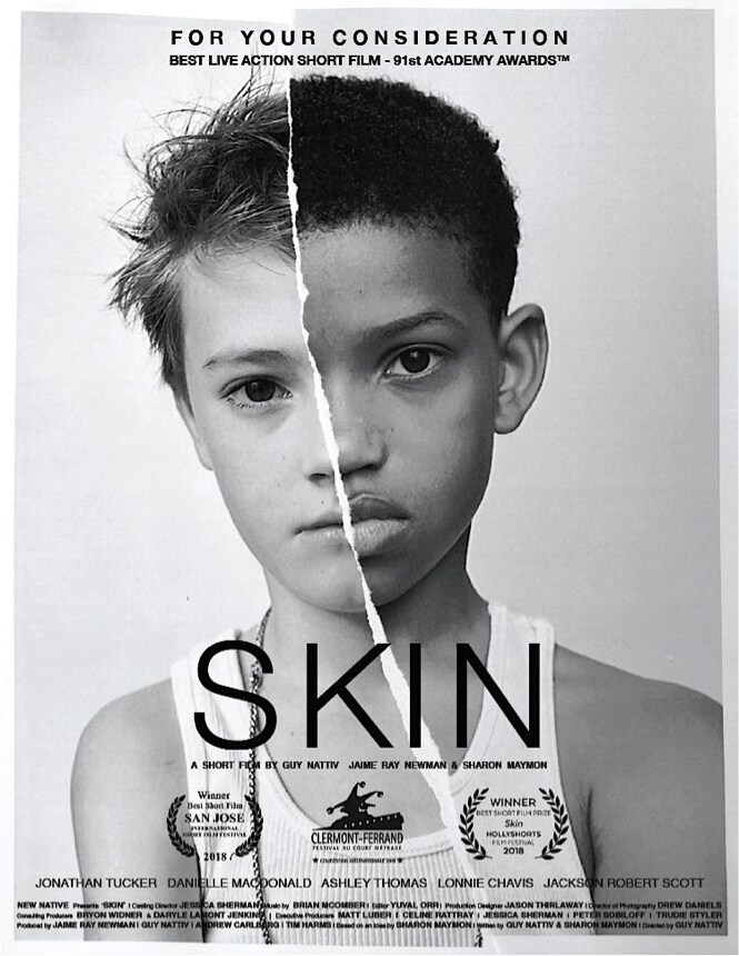 人種問題を子供の視点から描く「SKIN」短編が無料配信、抗議運動の広がりを受けて