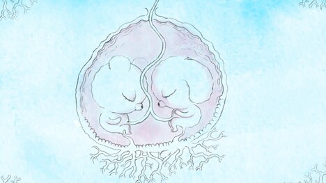 「ユニコーン・ブラッド」場面カット (c)sangre di unicornio