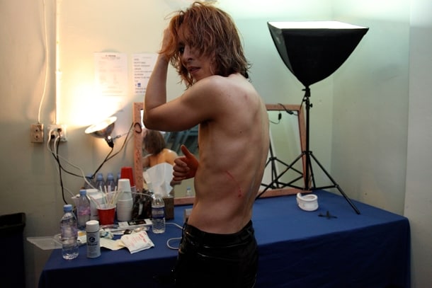 シカゴ公演終演後、背中に負った傷を見せるYOSHIKI。
