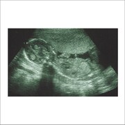 シングル「アタマカラダ」のジャケット。