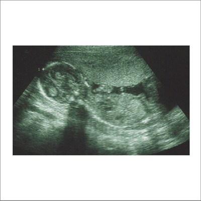 シングル「アタマカラダ」のジャケット。