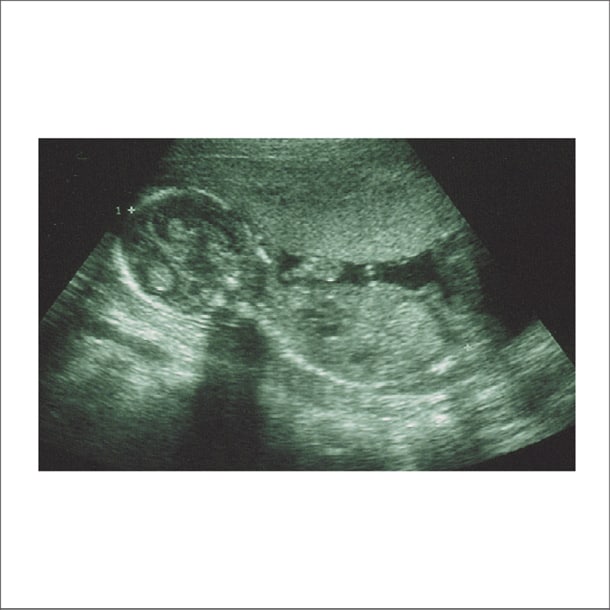 シングル「アタマカラダ」のジャケット。