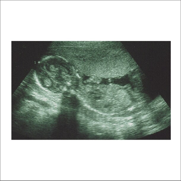 シングル「アタマカラダ」のジャケット。