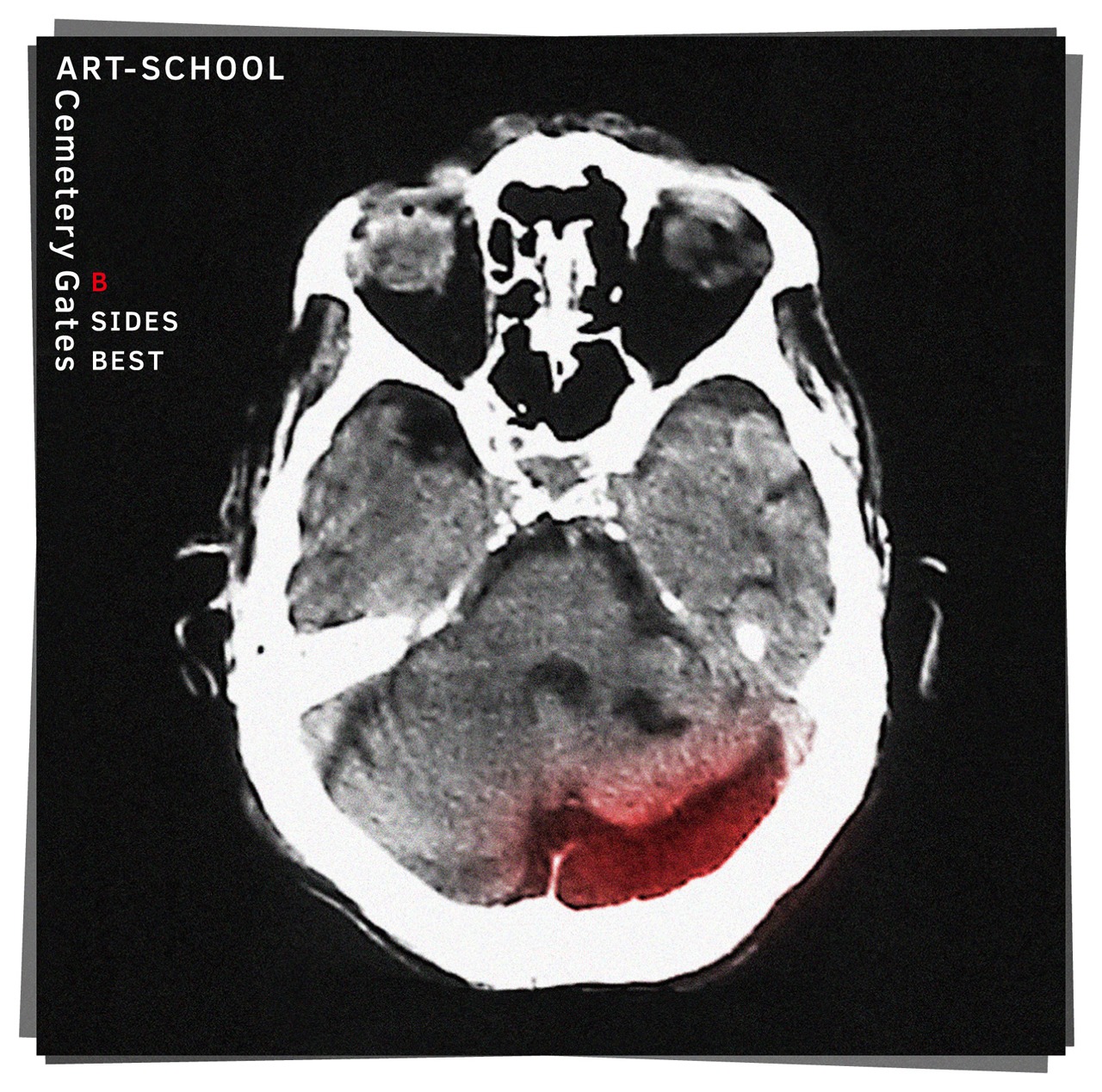 ART-SCHOOL「Cemetery Gates」ジャケット