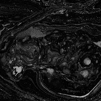 BiS「Are you ready?」初回限定盤ジャケット