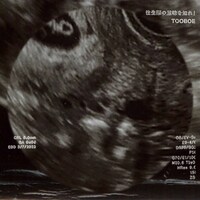 TOOBOE「往生際の意味を知れ！」配信ジャケット