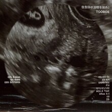 TOOBOE「往生際の意味を知れ！」配信ジャケット