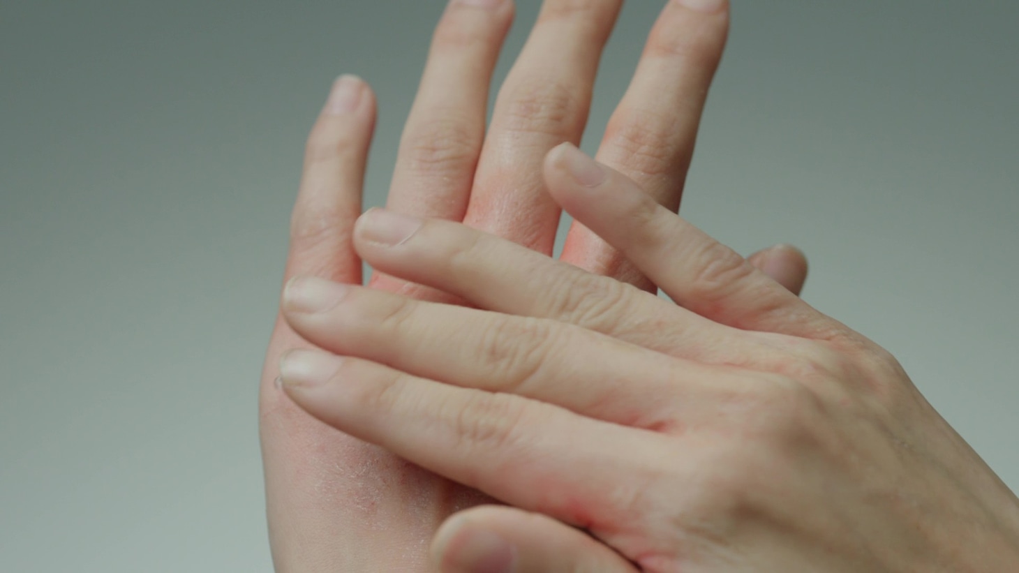 「リンデロンVs」CMのワンシーン。