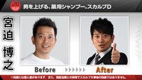 雨上がり決死隊宮迫の髪型Before＆After。芸人としてデビューしてから、このプロジェクトに参加するまで髪型を変えていなかった。