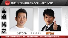 雨上がり決死隊宮迫の髪型Before＆After。芸人としてデビューしてから、このプロジェクトに参加するまで髪型を変えていなかった。