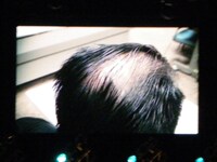 モニターに映し出された小杉の頭頂部。