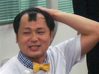 ハゲが進んできたことを明かされたアンダーエイジ。(c)吉本興業