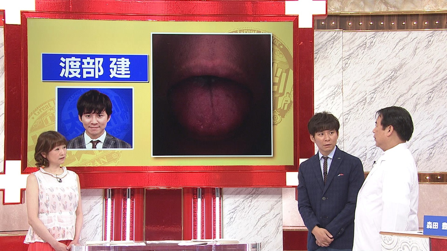 「今夜解決！噂の健康術 名医のTHE太鼓判！」で「舌の健康チェック」を行った番組MCのアンジャッシュ渡部。(c)TBS