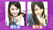 歌恋の整形前と整形後。(c)日本テレビ
