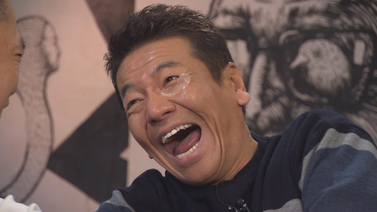 ヒアルロン酸を針状に加工したシートを目の下に貼る、くりぃむしちゅー上田。(c)中京テレビ