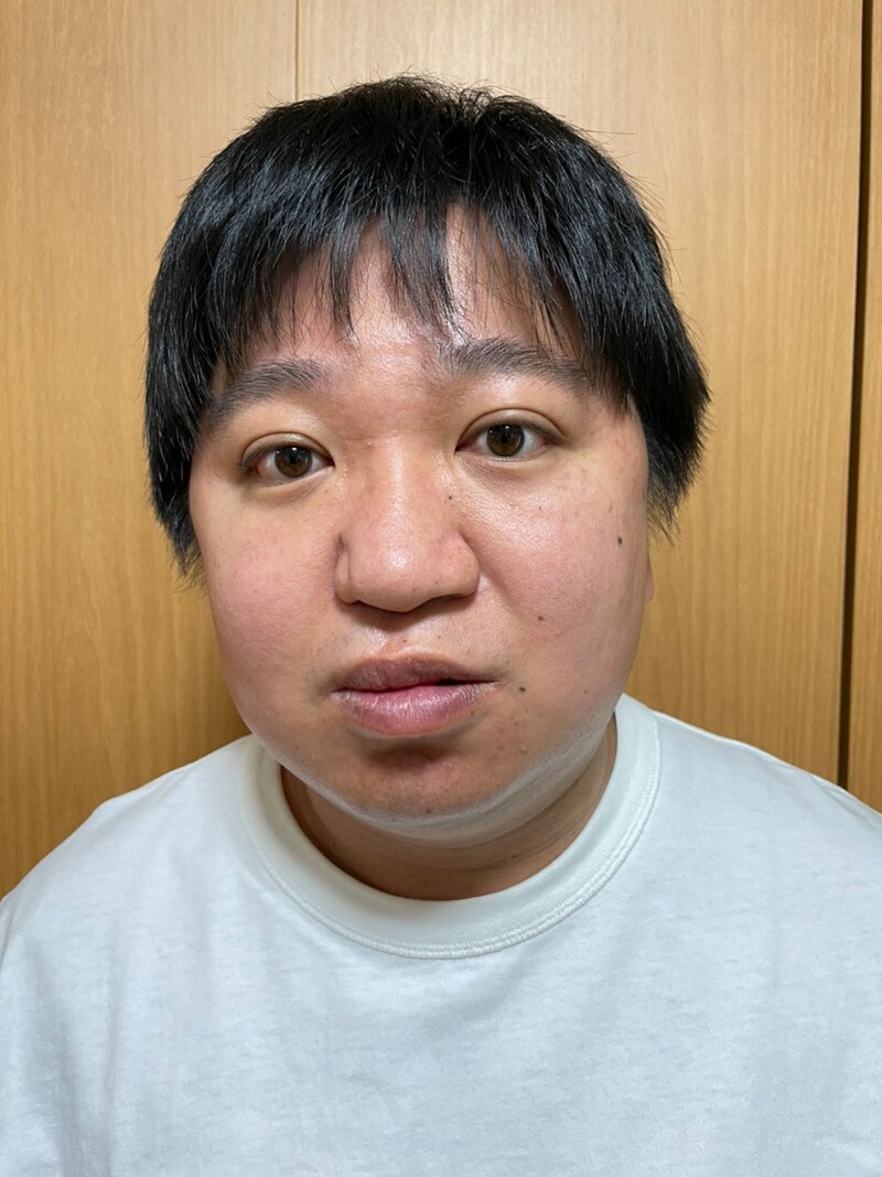 「ケツの顔にタイトルを」の題材となるニッポンの社長・ケツの写真。