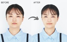 マッサージでむくみが解消された蛙亭イワクラのビフォアフター。