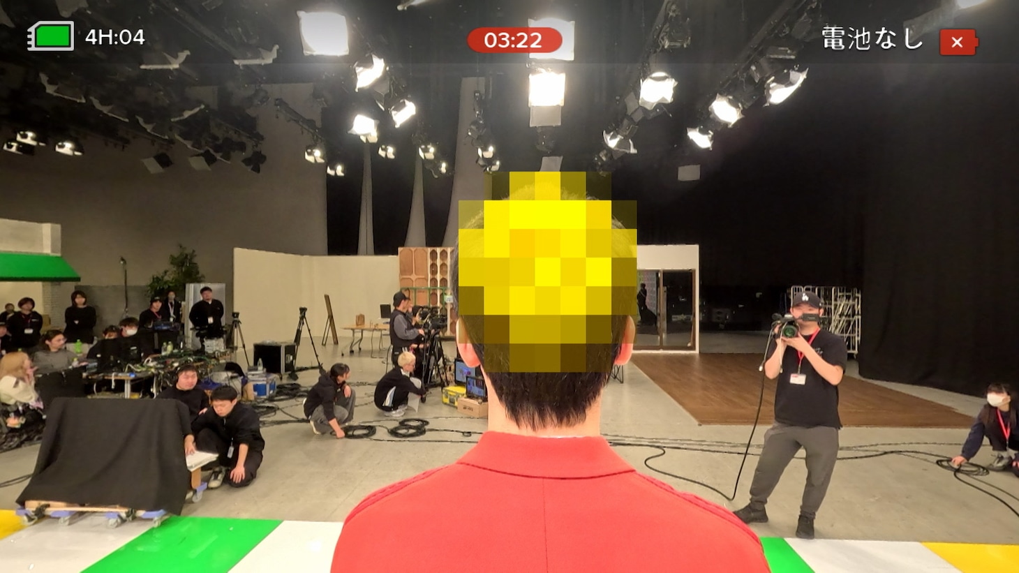 かまいたち濱家の頭皮をチェックする様子